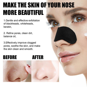 10 Pcs Blackhead Nose patch for men and women